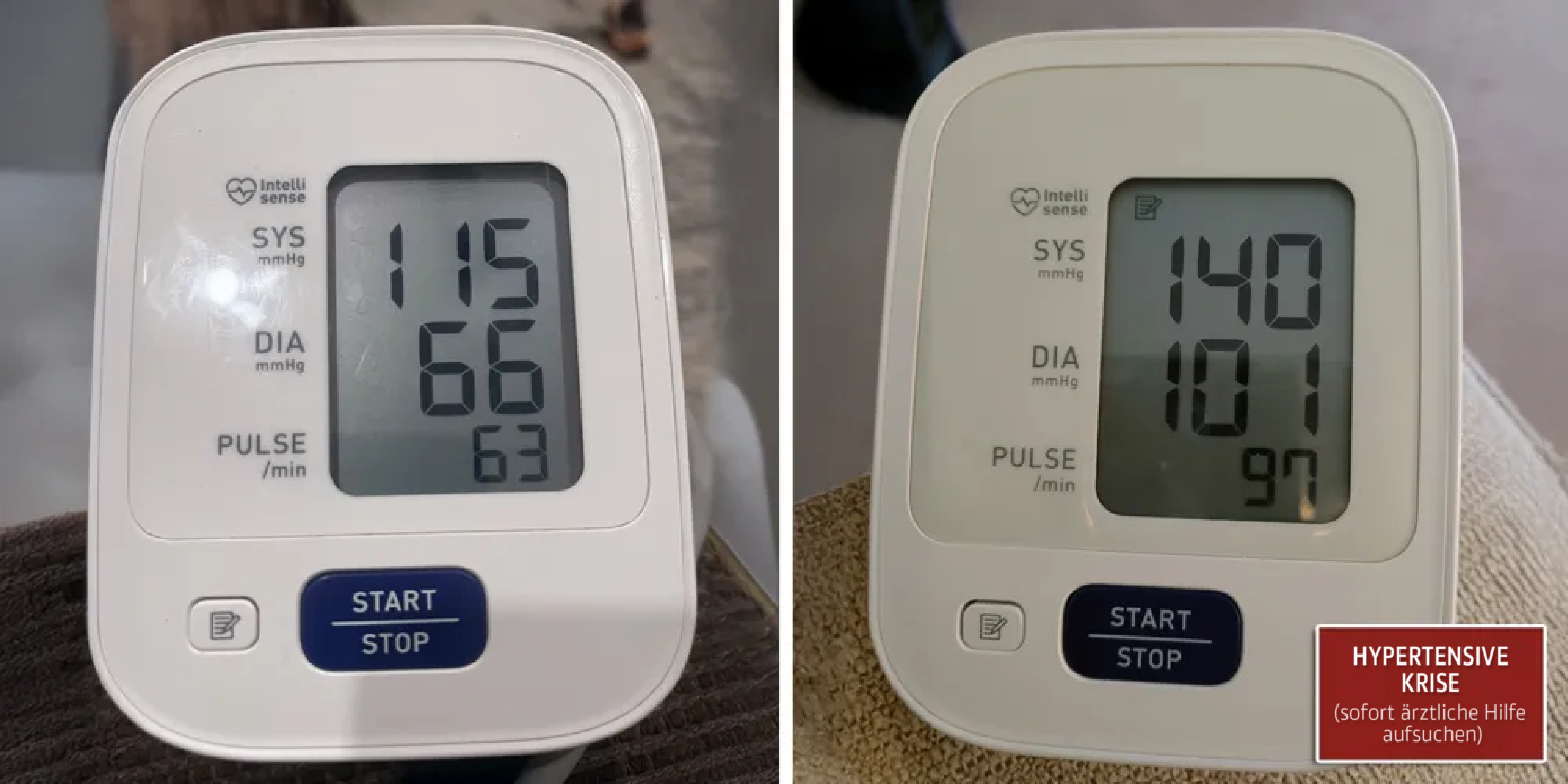 Derila sleep apnea 2 hypertensive crisis C SM DE